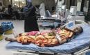 مرضى فلسطينيون يخضعون لجلسات غسيل الكلى في مستشفى شهداء الأقصى بدير البلح، في 5 أغسطس/آب 2026، وسط نقص حاد في الأدوية والمستلزمات الطبية عقب استهداف مستودع للإمدادات العلاجية. (تصوير: معز صالحي)