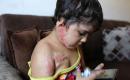 الطفلة الفلسطينية مسك أبو معزة، 3 سنوات، في مخيم الشاطئ بمدينة غزة، ولا تزال تعاني آثار حروق بالغة أُصيبت بها جراء غارة جوية إسرائيلية في ديسمبر/كانون الأول 2025. (تصوير: محمد صالحة)