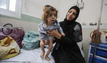 أطفال يتلقون الرعاية الصحية في مستشفى الرنتيسي بمدينة غزة بسبب سوء التغذية (3).jpg