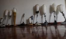 فلسطينيون، بينهم أطفال، يتلقون جلسات تأهيل باستخدام أطراف صناعية في مستشفى حمد للتأهيل بمنطقة (20).jpg