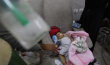 تتلقى الطفلة الفلسطينية سما أبو عجوة، المصابة بمرض نادر، رعاية طبية محدودة في مستشفى الشفاء بمدينة غزة، 19 ديسمبر/كانون الأول 2025. تصوير: عمر أشتوي