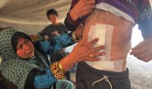 يتعرض الفلسطينيون النازحون الذين يعيشون في خيام بخان يونس باستمرار لنيران الجيش الإسرائيلي وسط ظروف معيشية مزرية ومخاطر تهدد حياتهم بسبب الهجمات الإسرائيلية المتواصلة وانعدام المأوى الآمن، 27 يناير/كانون الثاني 2026. صورة: طارق محمد