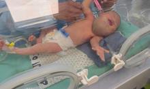 تتلقى الطفلة الفلسطينية دعاء قشطة، التي لم تتجاوز أيامًا معدودة من عمرها، العلاج في مستشفى ناصر بخان يونس، قطاع غزة، بسبب تورم حاد في حلقها يؤثر بشكل مباشر على تنفسها وتغذيتها، 18 يناير/كانون الثاني 2026. صورة: طارق محمد