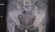 نجاح جهود استعادة خدمات التصوير الطبي التشخيصية بتفعيل التصوير الطبي الملون 1.jpg