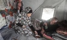 تجلس الفلسطينية سحر محمود التلولي، 43 عامًا، داخل خيمة في مخيم البريج للاجئين وسط قطاع غزة، بعد أن أصيبت يدها اليسرى وتشوهت جراء القصف الإسرائيلي، وذلك بعد نزوحها المتكرر من شمال القطاع.تصوير: معز صالحي