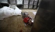 ودّع فلسطينيون جثماني مواطنين اثنين في مستشفى الشفاء بمدينة غزة. وبحسب مصادر عائلية، قُتل الرجلان على يد القوات الإسرائيلية في بيت لاهيا، شمال قطاع غزة، في 24 فبراير/شباط 2026. (صورة: عمر أشتوي)