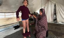 الطفلة رنين جندية مصابة بحروق في جسدها جراء غارة جوية إسرائيلية استهدفت خيمة قرب مخيمها في خان يونس، وتحتاج إلى استكمال العلاج خارج قطاع غزة.مدينة غزة، 1 فبراير/شباط 2026. صورة: مطر الزاق.