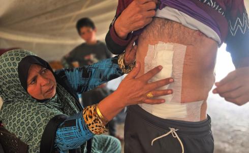 يتعرض الفلسطينيون النازحون الذين يعيشون في خيام بخان يونس باستمرار لنيران الجيش الإسرائيلي وسط ظروف معيشية مزرية ومخاطر تهدد حياتهم بسبب الهجمات الإسرائيلية المتواصلة وانعدام المأوى الآمن، 27 يناير/كانون الثاني 2026. صورة: طارق محمد