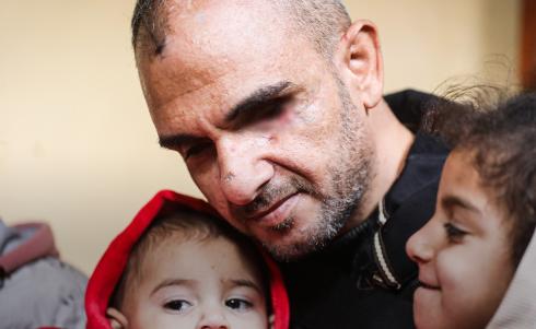 الجريح الفلسطيني أحمد حرز الله.jpg