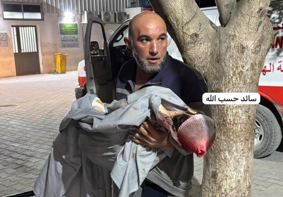 وصول شهيدة طفلة ثانية إلى مجمع الشفاء الطبي وهي الطفلة زينة الصفدي