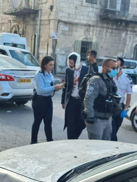 اصابة شاب جراء دعسه في بلدة الطور بالقدس