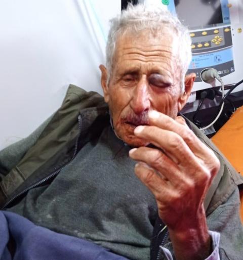 المسن محمود فقها بعد الاعتداء عليه من قبل المستوطنين.jpg