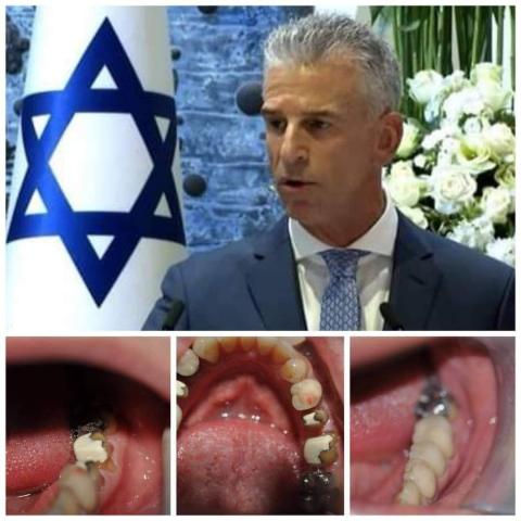 قراصنة إيرانيون اخترقوا هاتف رئيس جهاز الموساد ونشروا صورًا لأسنانه