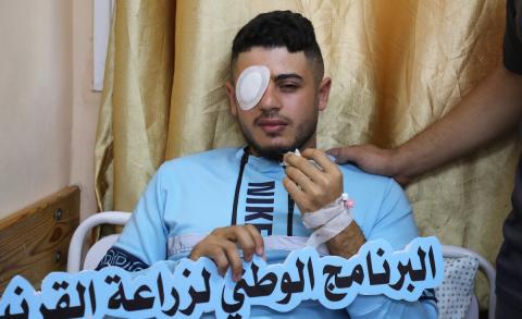 مرضى فلسطينيون يرقدون في مستشفى العيون بعد اجراء عملية زراعة قرنية ضمن حملة البرنامج الوطني لزراعة القرنيات في مدينة غزة