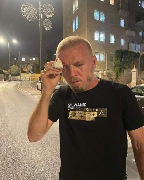 اعتداء بالضرب على مقدسي من بلدة سلوان.jpg