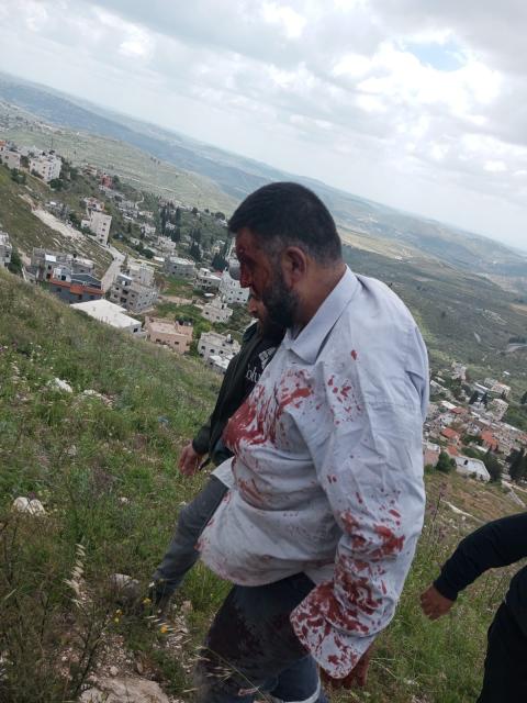 إصابة مواطنين في بلدة برقة شمال غرب نابلس و تكسير 155 شجرة زيتون