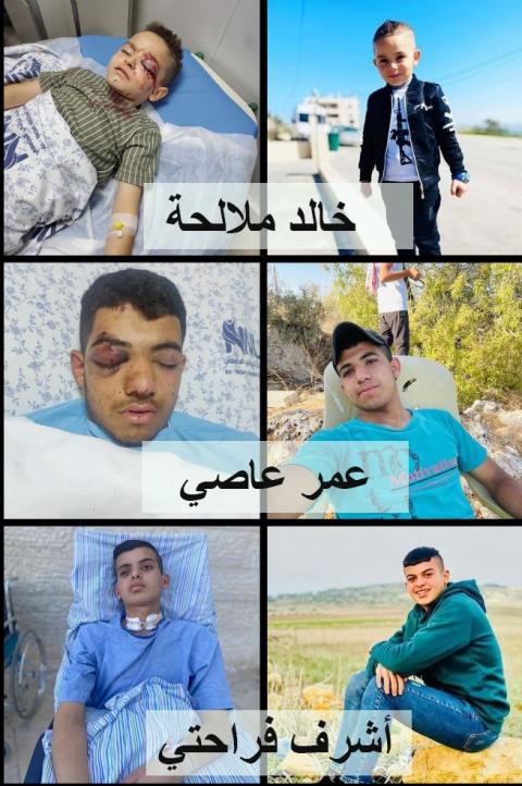"الحركة العالمية": الاحتلال يتسبب بفقدان ثلاثة أطفال لأعينهم منذ بداية العام الجاري