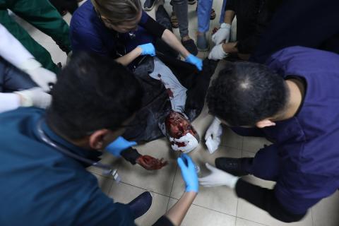 نقل الجرحى الفلسطينيين (بينهم أطفال) إلى مستشفى شهداء الأقصى في دير البلح لتلقي العلاج إثر العدوان الإسرائيلي على قطاع غزة، يوم 21 مارس 2024. تصوير: علي حمد
