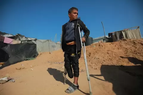 طفل فلسطيني مبتور القدم وفي عينه نظرة تحدِ.webp