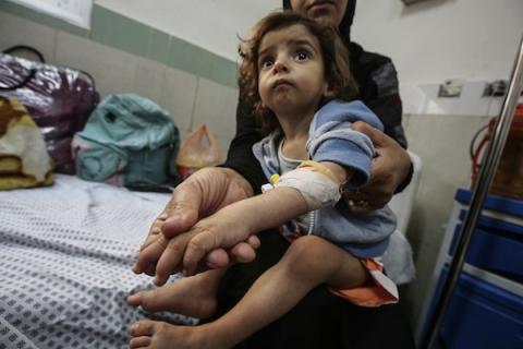 أطفال يتلقون الرعاية الصحية في مستشفى الرنتيسي بمدينة غزة بسبب سوء التغذية (2).jpg