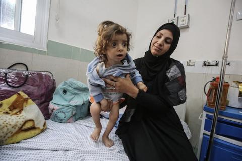 أطفال يتلقون الرعاية الصحية في مستشفى الرنتيسي بمدينة غزة بسبب سوء التغذية (3).jpg