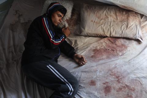 الشاب الفلسطيني أحمد أبو سعادة (20عاماً) يفقد القدرة على الكلام نتيجة الصدمة التي ألمّت به جراء فقدان زوجته ولاء جحا،  إثر غارة جوية إسرائيلية على غزة، بعد ثلاثة أيام فقط من زفافهما،  7 يناير/كانون الثاني 2025. صورة: عمر أشتوي