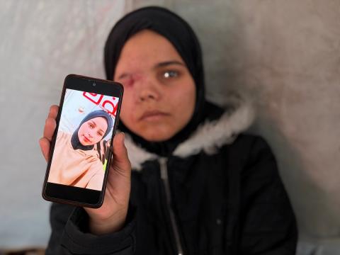 ندى رحومة، طفلة (16 عامًا) نازحة بمنطقة الزوايدة وسط القطاع، ُأصيبت في غارة إسرائيلية قرب خيمة عائلتها في مدينة غزة وفقدت إحدى عينيها، وهي مُعرّضة لخطر فقدان البصر في العين الأخرى إذا لم تتلقَّ علاجًا طبيًا عاجلًا، 10 فبراير/شباط 2026. تصوير: محمد الأسود