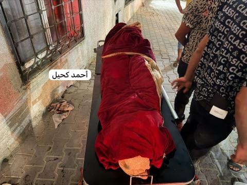 وصول شهيدة واصابة الان مجمع الشفاء الطبي من حي الزيتون.jpg