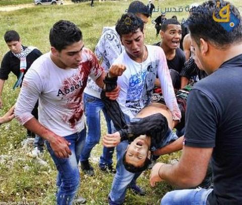 إصابة 3 مواطنين برصاص قوات الاحتلال شمال قطاع غزة