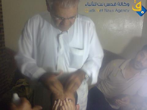 صور.. عامل فلسطيني يبتكر تركيبة زيوت طبيعية تعالج الصلع والثعلبة وتساقط الشعر خلال عدة اسابيع