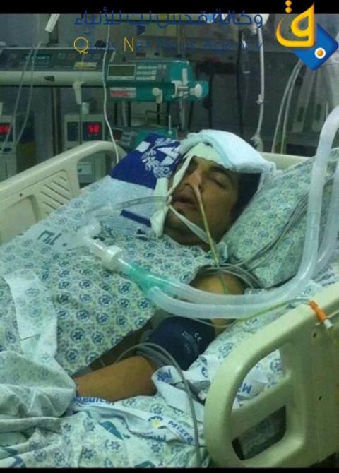 استشهاد شاب مقدسي بعد صراع دام 4 سنوات مع اصابته برصاص مطاطي