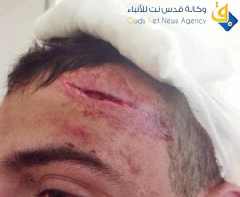 صور.. مستوطنون يضربون 3 مقدسيين وإحدى الإصابات خطيرة