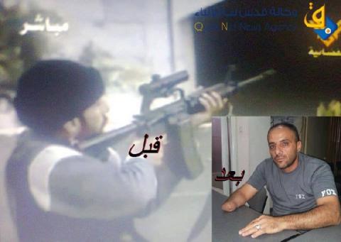 صور.. محرر يده مبتورة يضرب عن الطعام غدا أمام المقاطعة