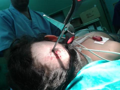 غزة.. أطباء بمجمع الشفاء ينفذون حياة طفلة من الموت