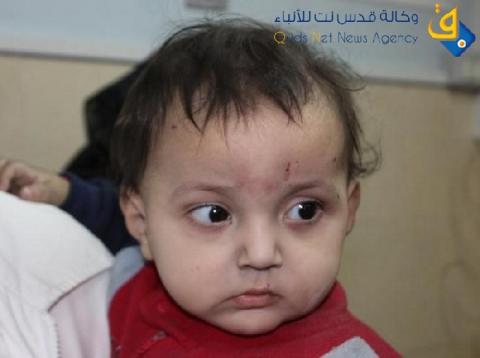 الصحة تقلل من تحذير الاونروا: تطعيمات للأطفال بقيمة (6) مليون دولار تصل خلال اسبوعين