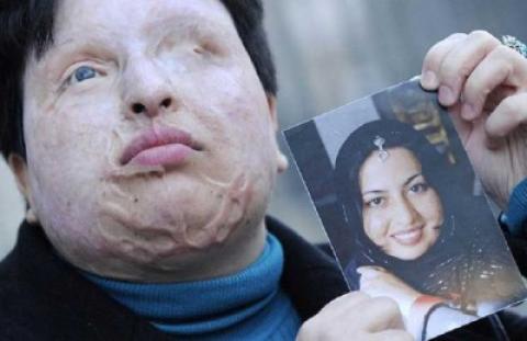 الحكم على إيراني باقتلاع عينيه وقطع أذنه