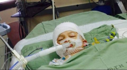 الصحة: عملية زراعة جلد وتنظيفات ستُجرى للناجين من عائلة دوابشة