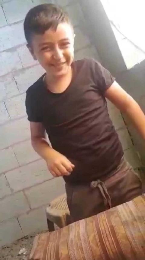 هل يستحق رأس هذا الطفل الجميل مائة شظية؟!!