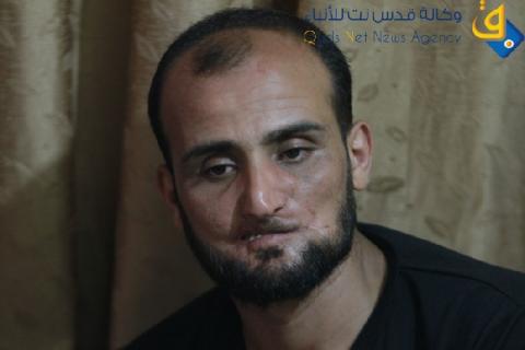 (37) عملية جراحية تفشل بانهاء مأساة مواطن غزي.. يناشد خادم الحرمين والرئيس أبو مازن
