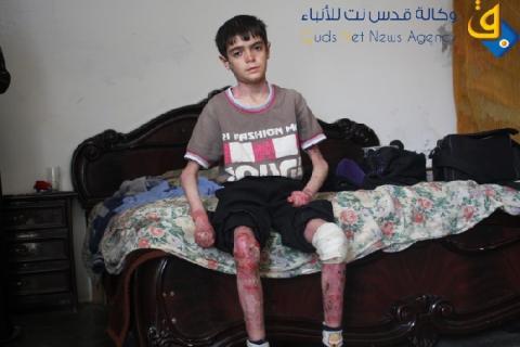 في سلفيت قصة طفل تقشعر لها الأبدان وتبكي الحجر فهل من مجيب..!؟