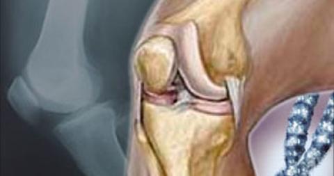 الكوع والركبة أشهر الأماكن الداكنة المزعجة فى الجسم