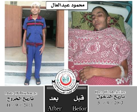 بالصور .. بعد سقوطه..مستشفى بغزة ينقذ شابا عشرينياً من الإعاقة