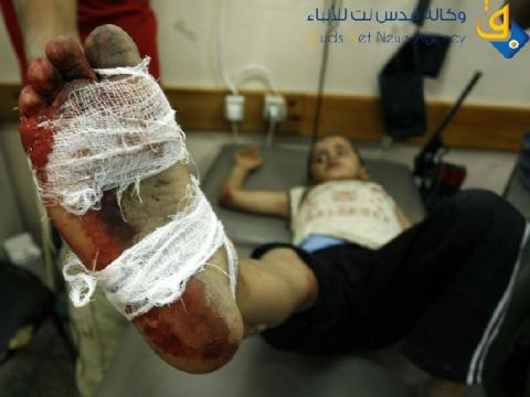 الشؤون: 40% من جرحى غزة بحاجة لأجهزة وبرامج محددة لذوي الاحتياجات الخاصة