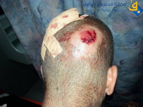 حالة غليان في باحات الاقصى اثر اقتحامه من قبل متطرفين يهود/عدسة:ديالا جويحان