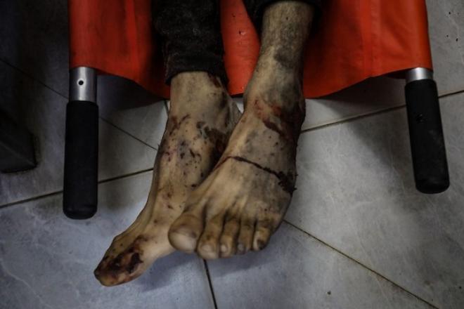 لحظات وداع يخيّم عليها الحزن، خلال تشييع موسى حمودة في مستشفى الشفاء بمدينة غزة، في 18 أكتوبر/تشرين الأول 2026، عقب استشهاده في غارة إسرائيلية بطائرة مسيّرة غرب المدينة.تصوير: محمد صالحة