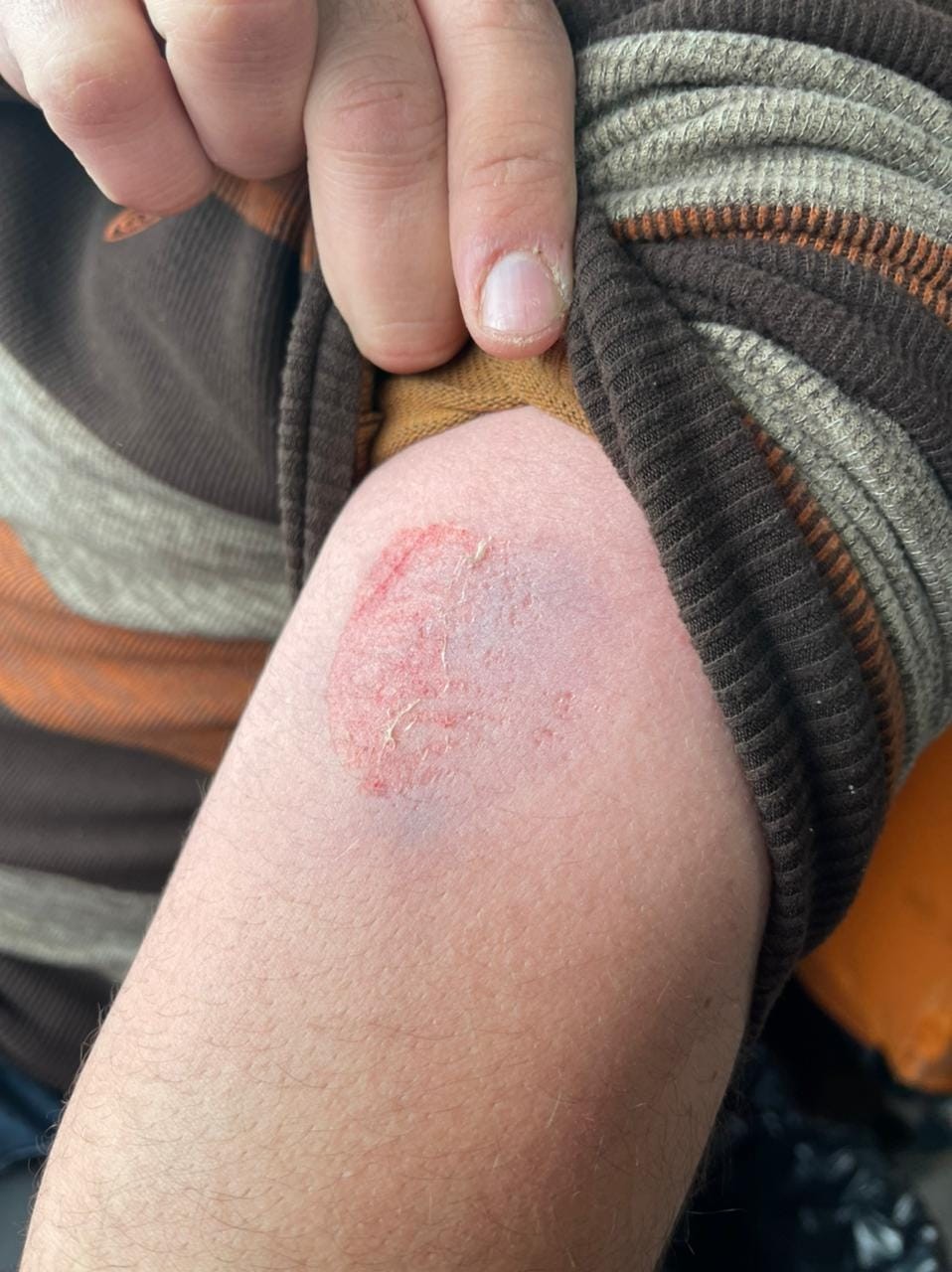 استهدفت قوات الاحتلال الاسرائيلي سيارة إسعاف تابعة للهلال الأحمر بالرصاص المعدني المغلف بالمطاط  ما أدى لأضرار في الزجاج الخلفي، وإصابة دكتور بالرصاص المطاط في كتفه أثناء تقديم الإسعاف الاولي لمصاب في مواجهات بيت دجن 3