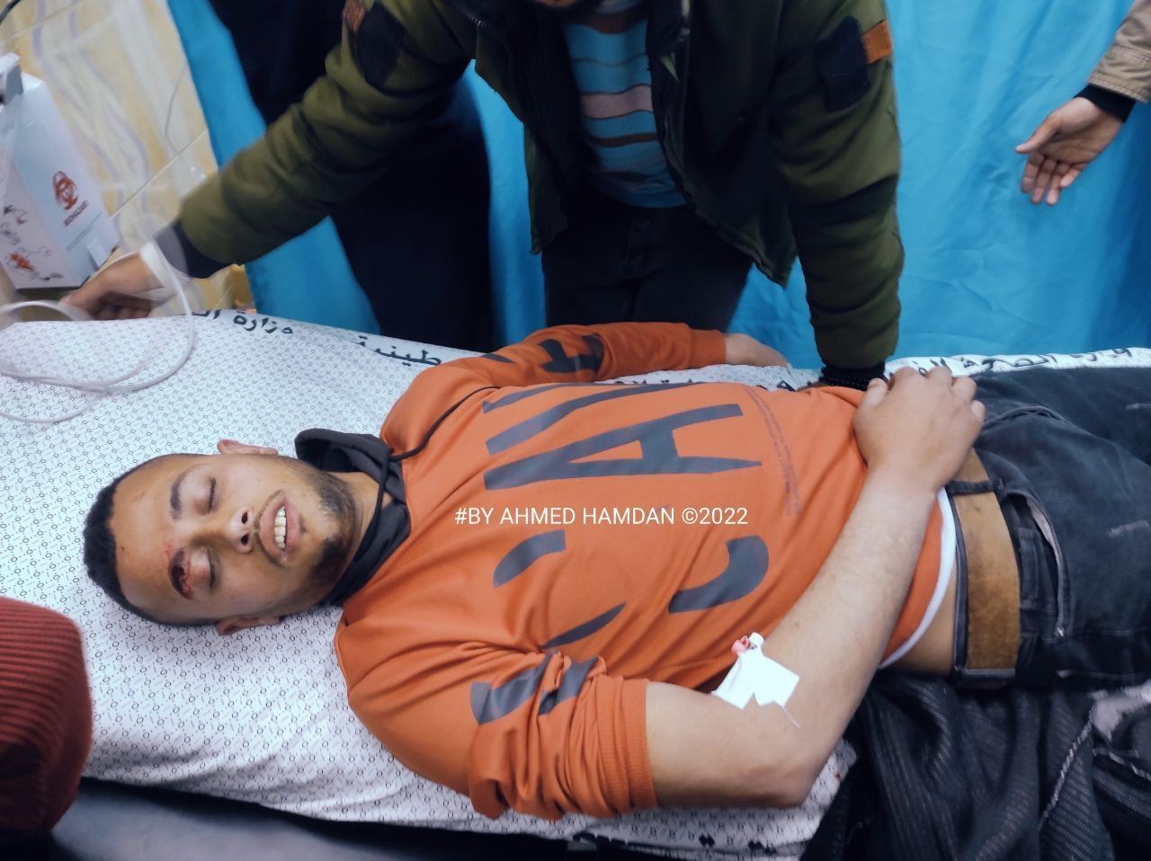 صورة لاحد المصابين في مستشفى بيت حانون بعد سقوط صاروخ بالقرب من السياج.jpg