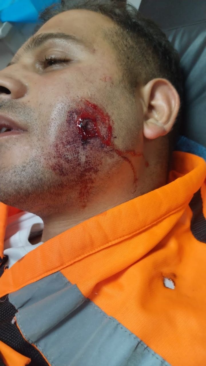 إصابة ضابط إسعاف بقنبلة غاز بشكل مباشر في وجهه في مواجهات بيت دجن.jpg