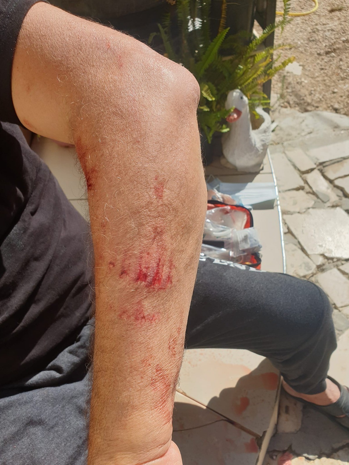 إصابتان في هجوم على قرية مادما جنوب نابلس 2.jpg