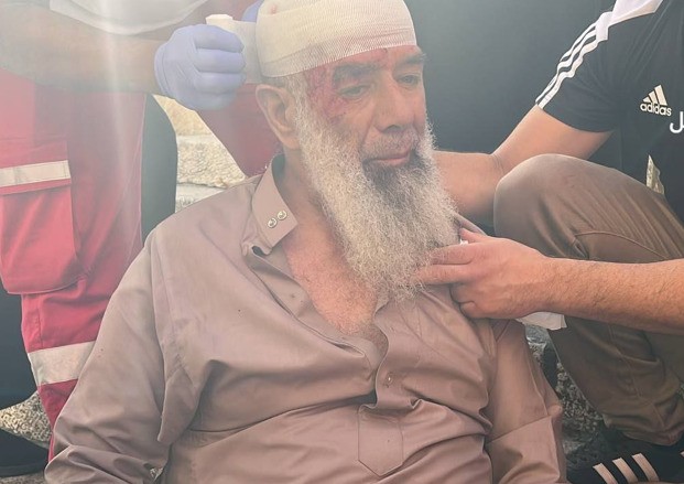 إصابة المرابط أبو بكر الشيمي إثر اعتداء قوات الاحتلال عليه في المسجد الأقصى 5.jpg